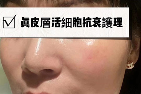 臉部項目7